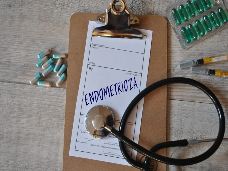 Błędy lekarskie w leczeniu endometriozy